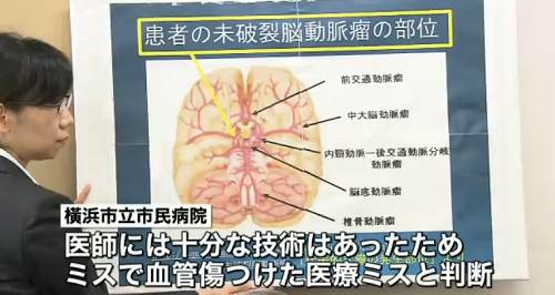 横浜市立市民病院で医療ミス！くも膜下出血で回復は見込めない状態
